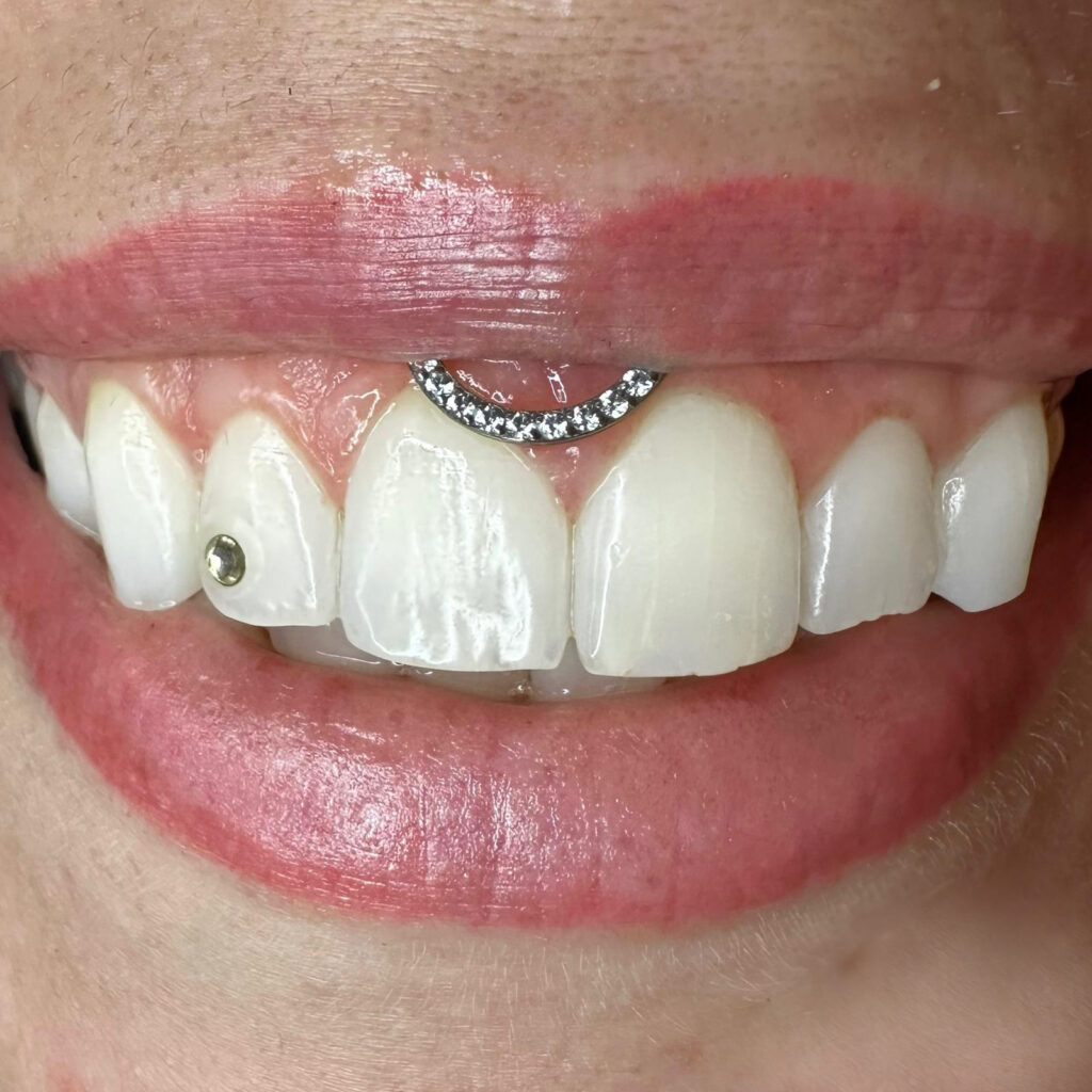 piercing gengiva
